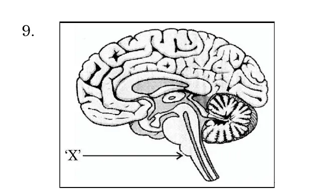 A drawing of the human brain in side view. The label X points to the lowest part, the medulla, at the base of the brain where it joins the spinal cord.